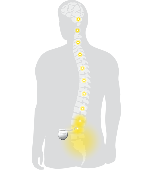 back graphic