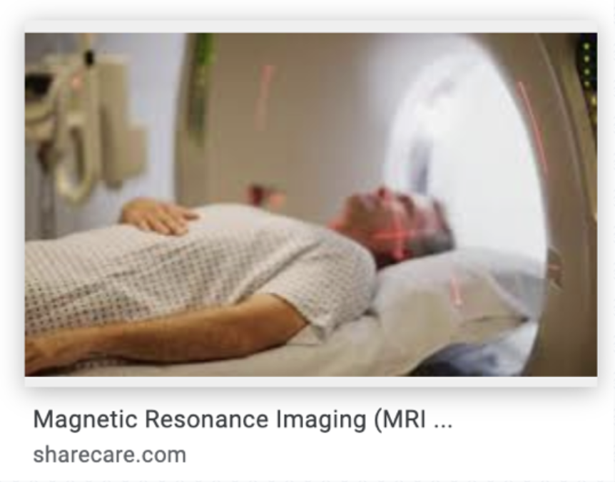 MRI Scans with Your Neurostimulation Device Abbott