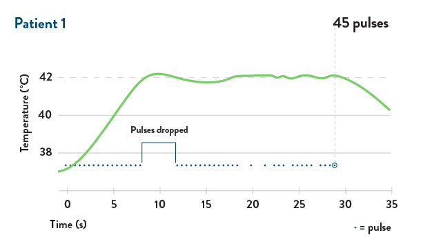 graph patient 1
