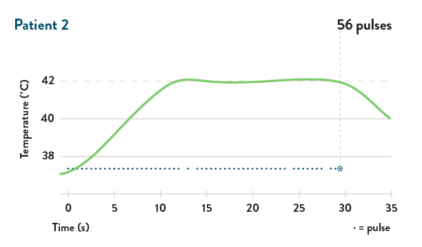graph patient 2