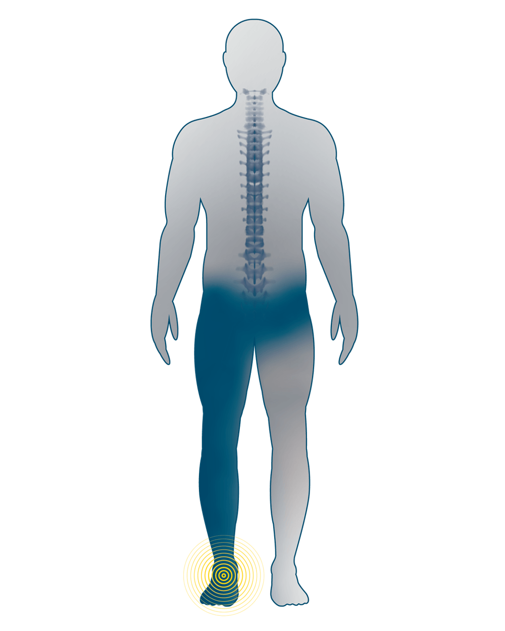 areas of pain