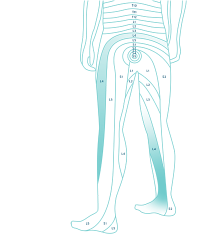 dermatome lower side graphic