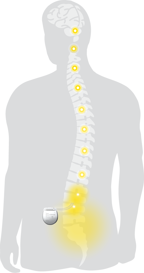 body diagram
