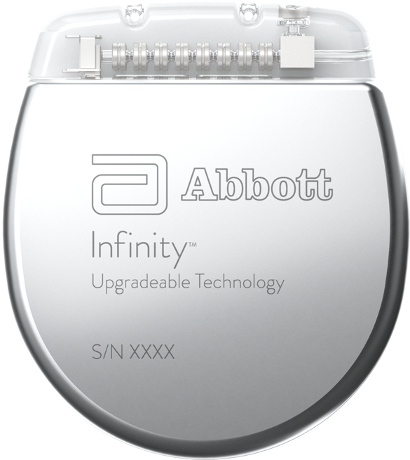 Abbott's Infinity™ Deep Brain Stimulation System | Abbott